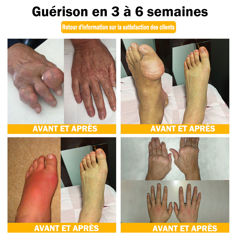 Raindew® Bee Venom Pain-Relief Bone Healing Cream 🐝🐝(Spécialement pour les personnes âgées & SOFCOT recommande)
