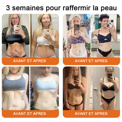"Fabriqué et expédié de France|✅ Boutique officielle✨lotmay® venin d'abeille Crème réparatrice au 🔥 DERNIER JOUR - 80 % DE RÉDUCTION 💎"