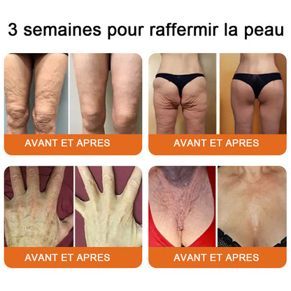 "Fabriqué et expédié de France|✅ Boutique officielle✨lotmay® venin d'abeille Crème réparatrice au 🔥 DERNIER JOUR - 80 % DE RÉDUCTION 💎"