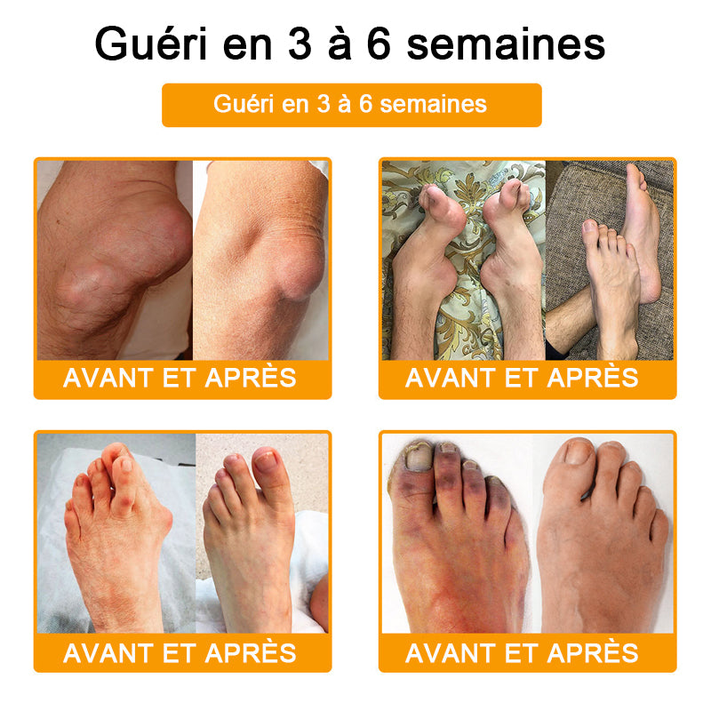 Lotmay® Crème de Réparation Articulaire au Venin d’Abeille contre la Douleur🐝🐝(Spécialement pour les personnes âgées)