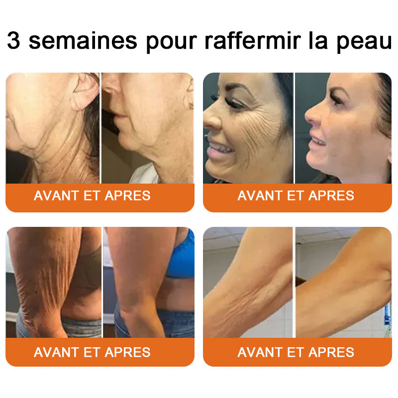 "Fabriqué et expédié de France|✅ Boutique officielle✨lotmay® venin d'abeille Crème réparatrice au 🔥 DERNIER JOUR - 80 % DE RÉDUCTION 💎"