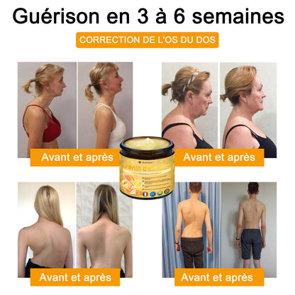 Raindew®venin d'abeille Crème Réparatrice Articulations(En particulier pour les personnes âgées & SOFCOT recommande)