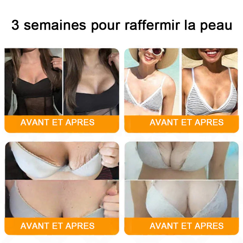 "Fabriqué et expédié de France|✅ Boutique officielle✨lotmay® venin d'abeille Crème réparatrice au 🔥 DERNIER JOUR - 80 % DE RÉDUCTION 💎"