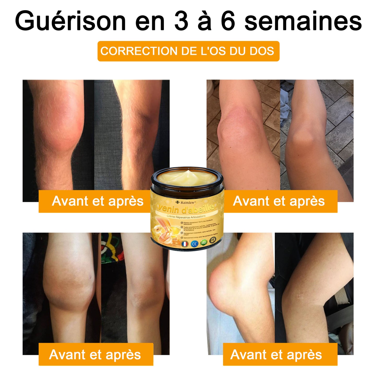 Raindew®venin d'abeille Crème Réparatrice Articulations(En particulier pour les personnes âgées & SOFCOT recommande)