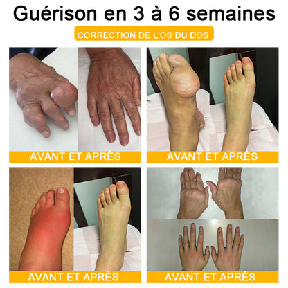 Lotmay® Crème de Réparation Articulaire au Venin d’Abeille contre la Douleur🐝🐝(Spécialement pour les personnes âgées)