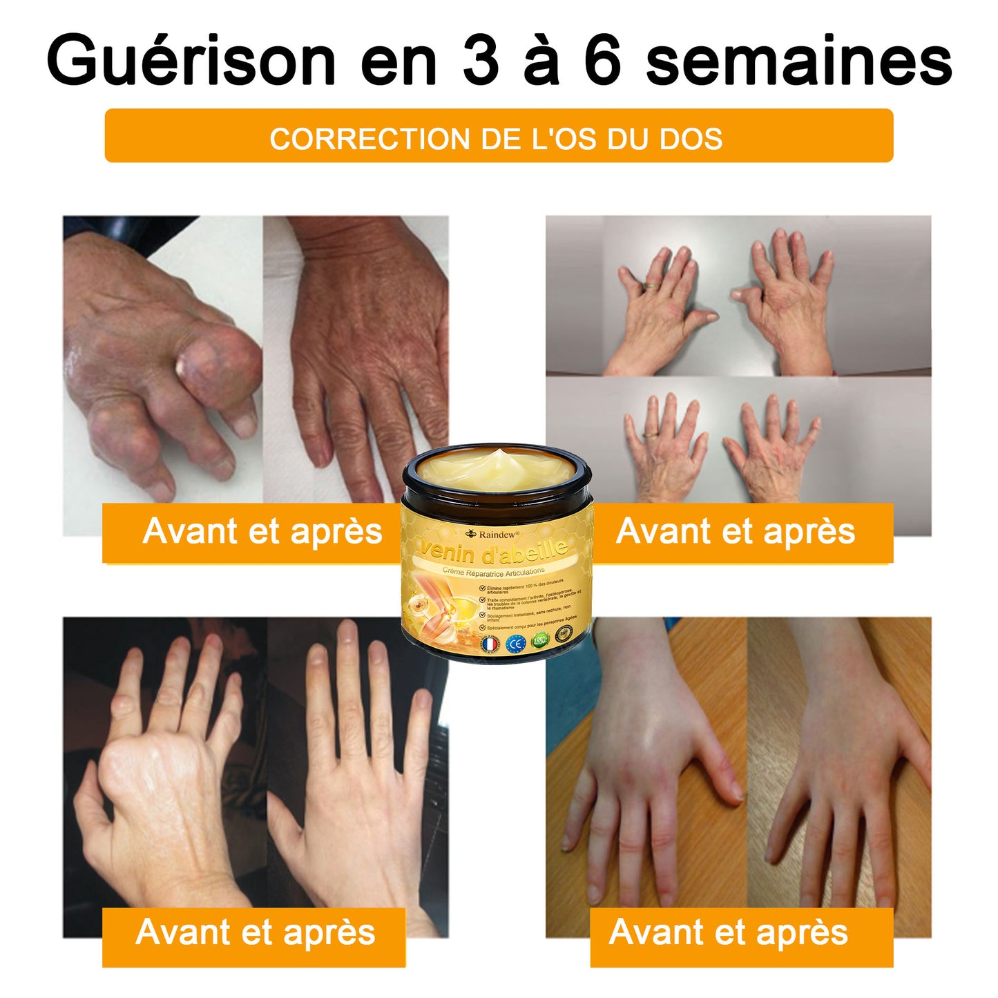 Raindew®venin d'abeille Crème Réparatrice Articulations(En particulier pour les personnes âgées & SOFCOT recommande)