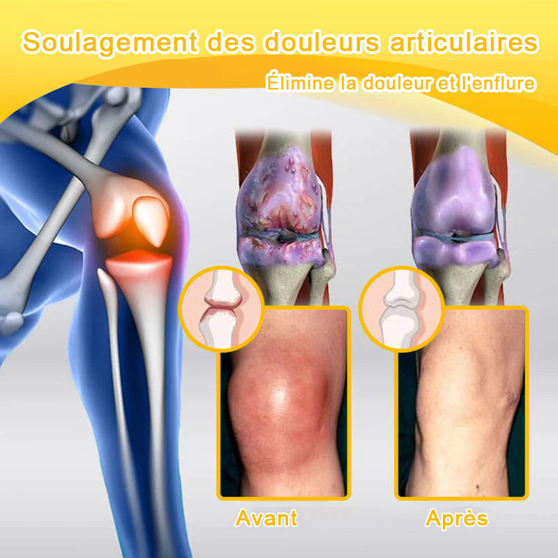 Lotmay® Crème de Réparation Articulaire au Venin d’Abeille contre la Douleur🐝🐝(Spécialement pour les personnes âgées)