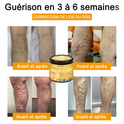 Raindew®venin d'abeille Crème Réparatrice Articulations(En particulier pour les personnes âgées & SOFCOT recommande)