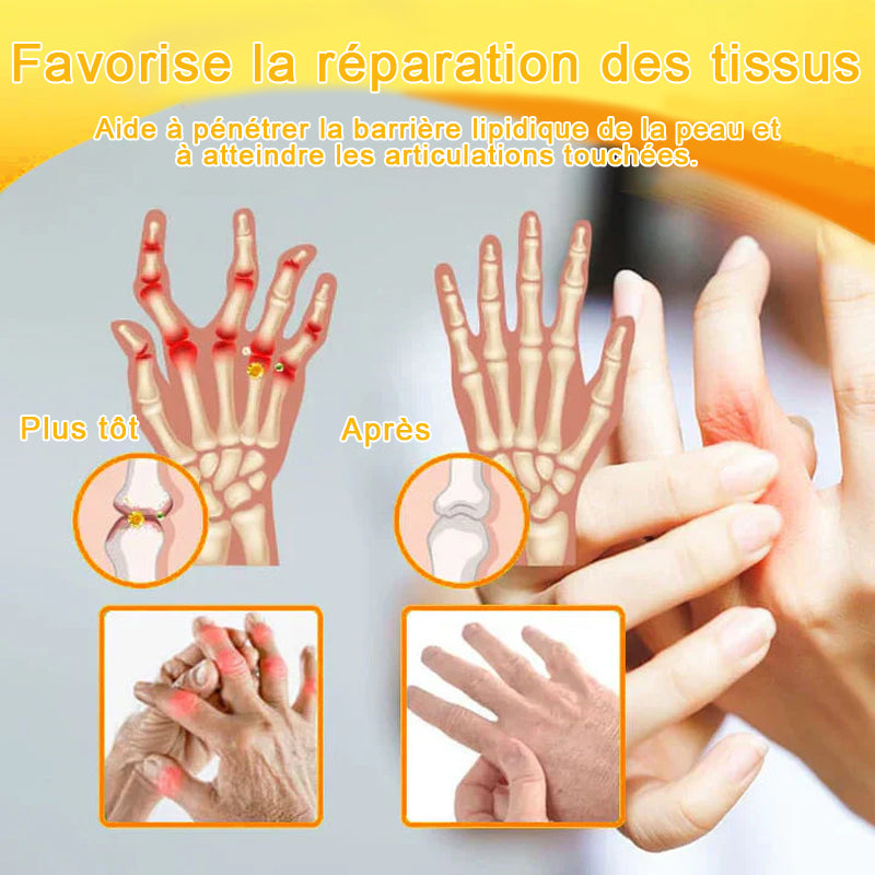 Lotmay® Crème de Réparation Articulaire au Venin d’Abeille contre la Douleur🐝🐝(Spécialement pour les personnes âgées)