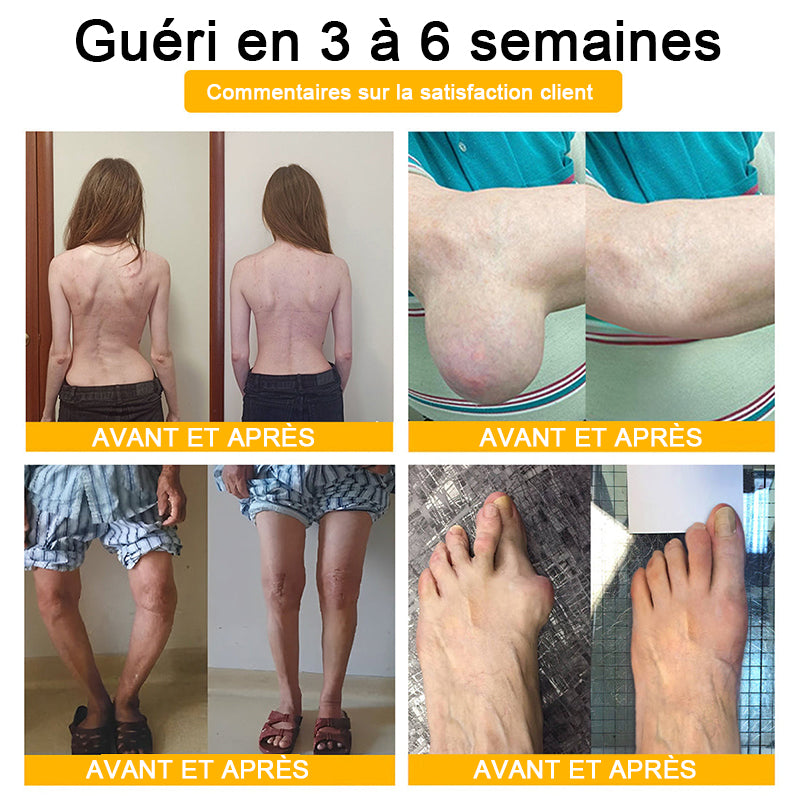 Lotmay® Crème de Réparation Articulaire au Venin d’Abeille contre la Douleur🐝🐝(Spécialement pour les personnes âgées)