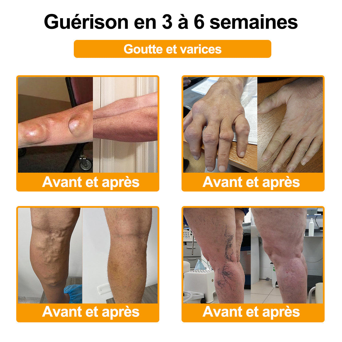 Raindew® 🐝  Botulinum Toxin & Bee Venom Pain-Relief Bone Healing Cream (crème cicatrisante osseuse à base de toxine botulique et de venin d'abeille)