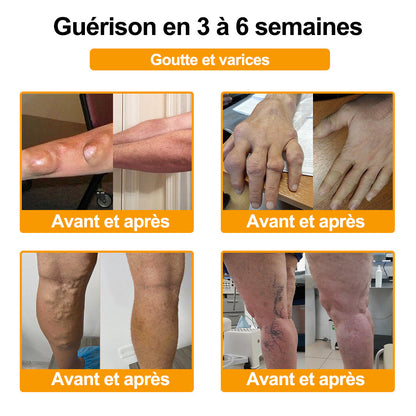 Raindew® 🐝  Botulinum Toxin & Bee Venom Pain-Relief Bone Healing Cream (crème cicatrisante osseuse à base de toxine botulique et de venin d'abeille)